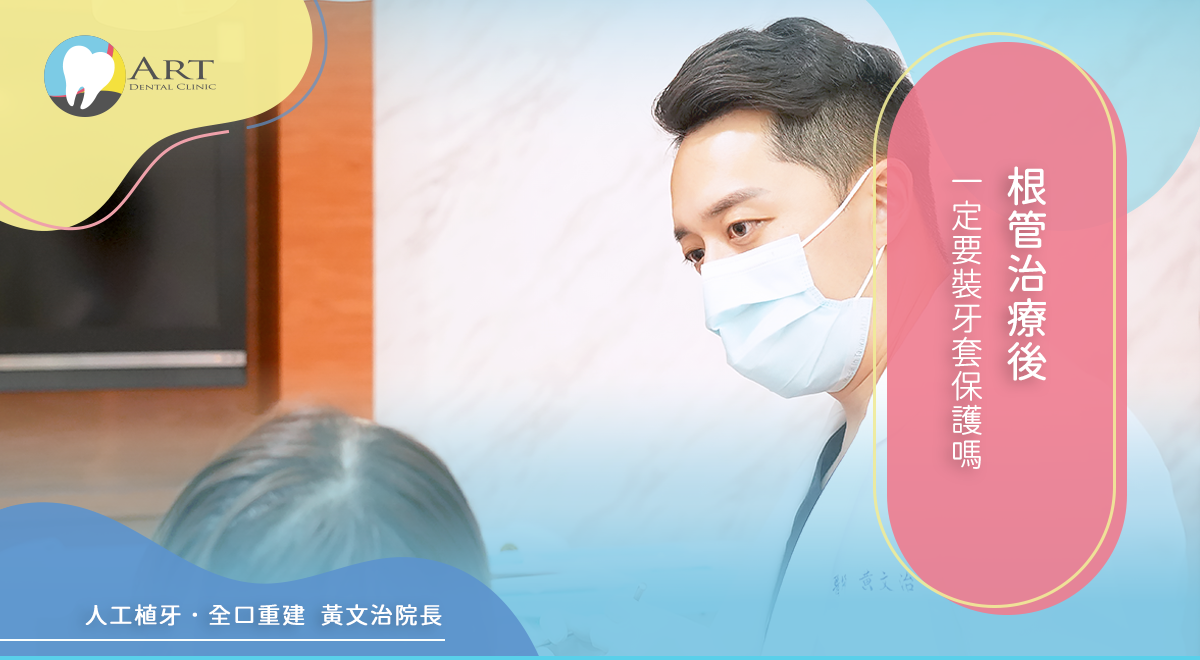 Read more about the article 根管治療後一定要裝牙套保護嗎