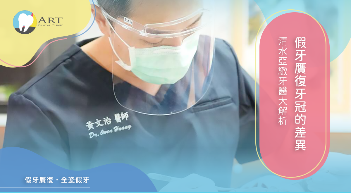 Read more about the article 假牙贋復牙冠的差異，清水亞緻牙醫大解析