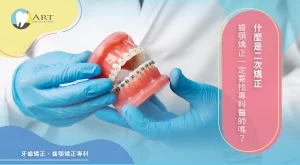 Read more about the article 什麼是二次矯正，齒顎矯正一定要找專科醫師嗎？