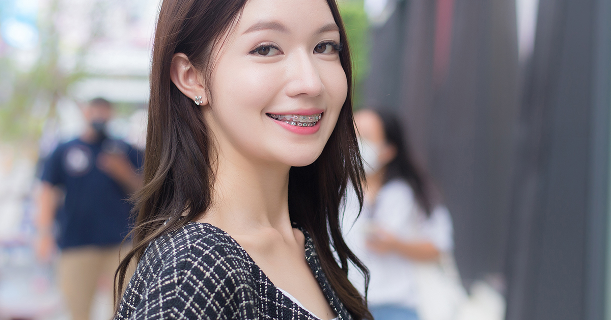 Read more about the article 什麼是二次矯正，齒顎矯正一定要找專科醫師嗎？