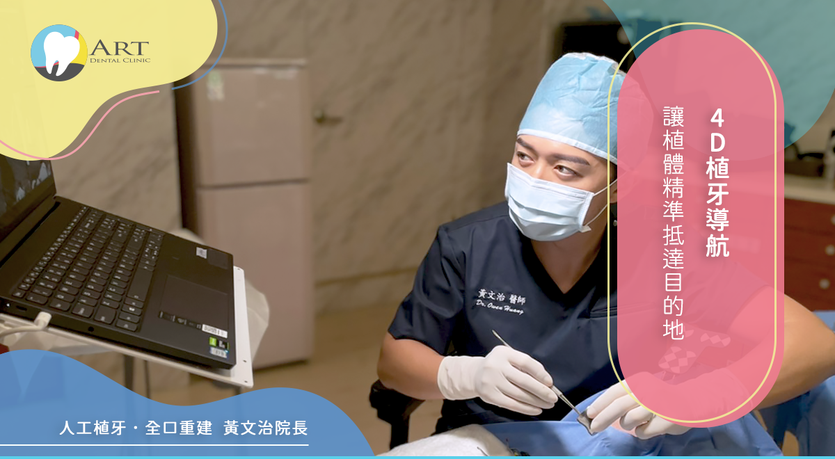 Read more about the article 4D植牙導航讓植體精準抵達目的地