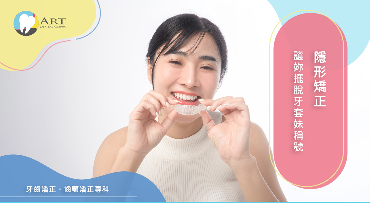 You are currently viewing 隱形矯正讓妳擺脫牙套妹稱號