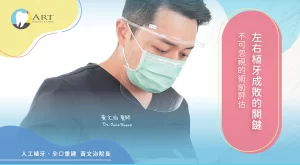 Read more about the article 左右植牙成敗的關鍵–不可忽視的術前評估