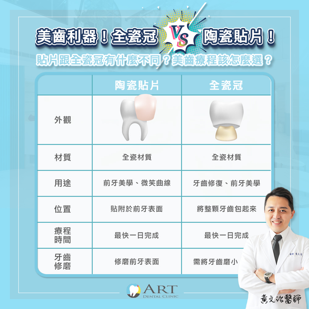 陶瓷貼片與全瓷冠的差別 - 清水亞緻牙醫 - 清水全口重建 牙周病 人工植牙 植牙導航 全瓷冠 牙齒修復，全瓷美學，清水陶瓷貼片推薦