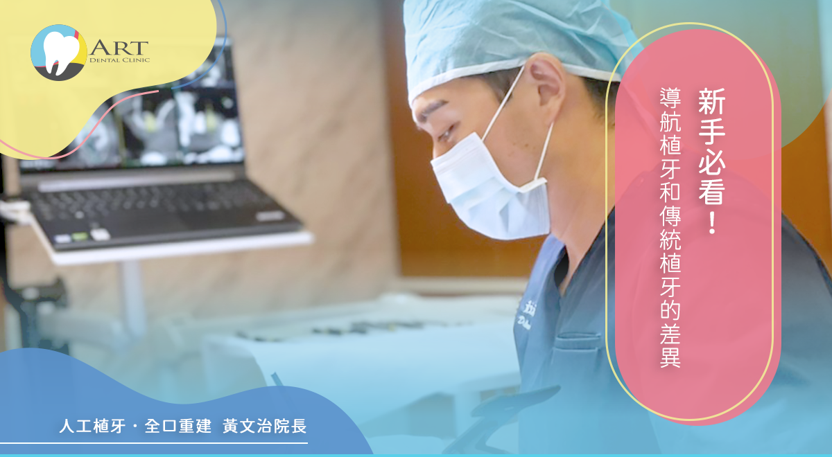 You are currently viewing 新手必看！導航植牙和傳統植牙的差異