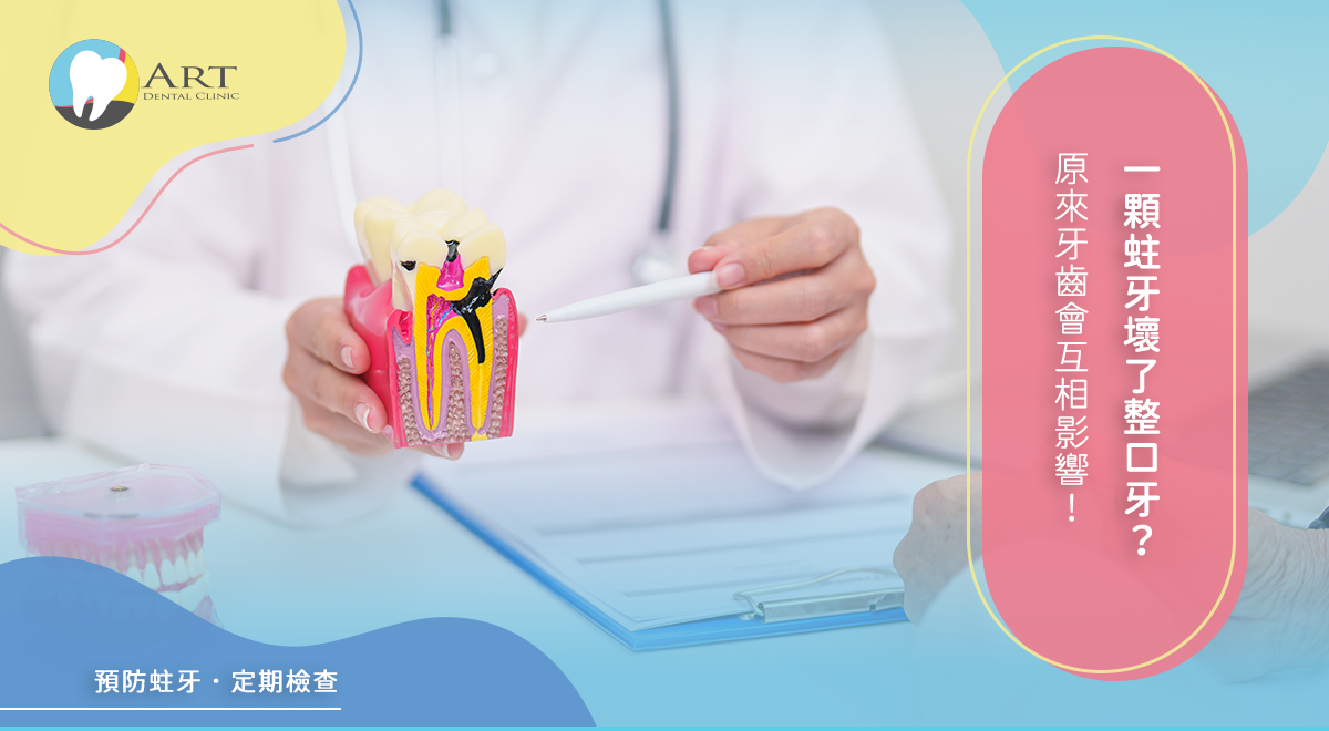 Read more about the article 一顆蛀牙壞了整口牙？原來牙齒會互相影響！