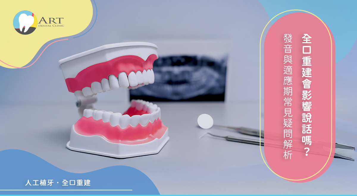Read more about the article 全口重建會影響說話嗎？發音與適應期常見疑問解析